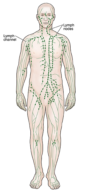Front view of male body outline showing lymphatic system, including lymph channels and lymph nodes.