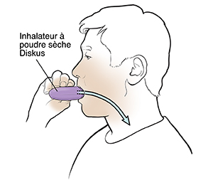 Un homme utilisant un inhalateur à poudre sèche.