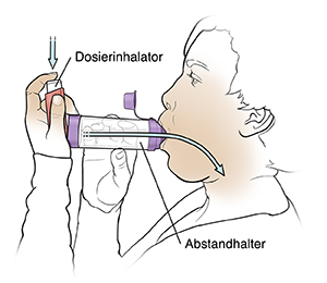 Frau, die einen Dosier-Inhalator mit einem Distanzhalter verwendet.