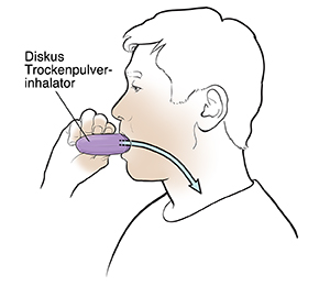 Mann, der einen Trockenpulverinhalator verwendet.