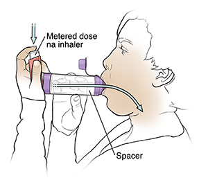 Babaeng gumagamit ng metered-dose na inhaler na may spacer.
