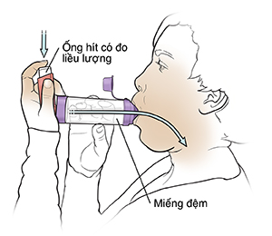 Người phụ nữ đang dùng ống hít định liều kèm ống đệm.
